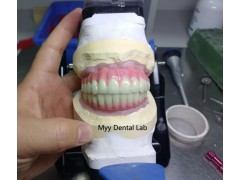 深圳义齿加工厂 出口外贸 Dental implant-数字化种植