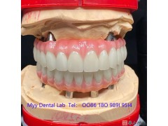 深圳义齿加工厂 出口外贸 Dental implant-数字化种植图2